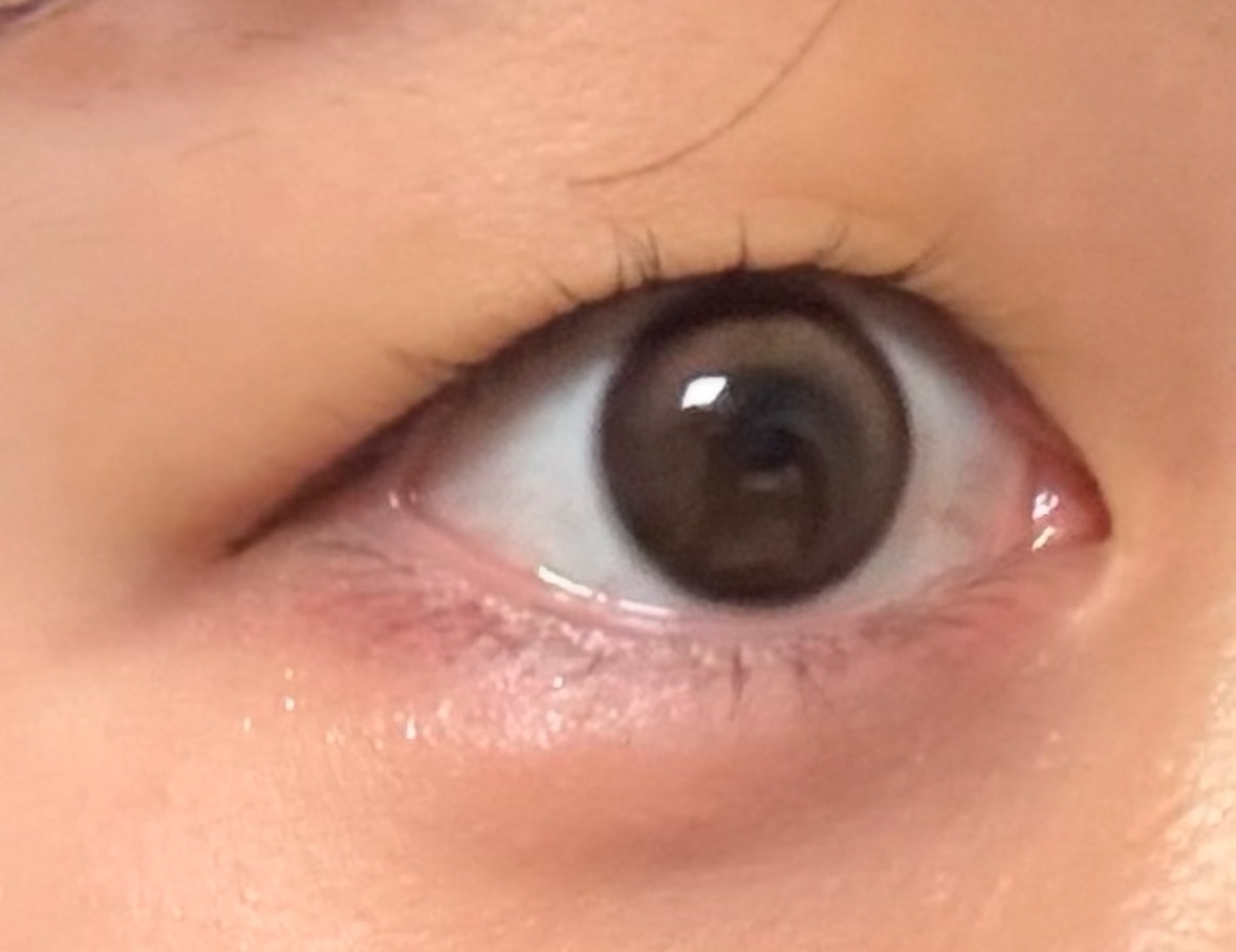 쌍수 할말 골라주세요 ㅜㅜ