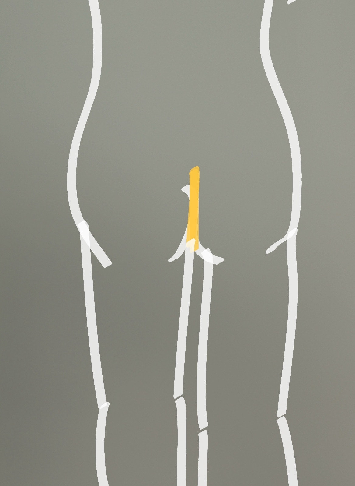 comment image 1