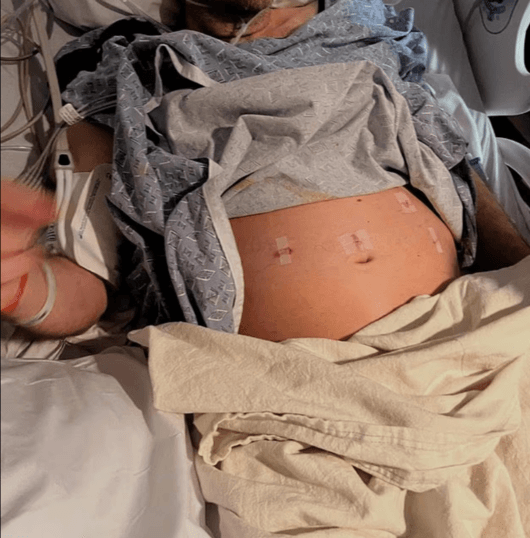 페레즈 힐튼, 패혈증 사경 헤매다 또 응급 수술.."죽음의 문턱"