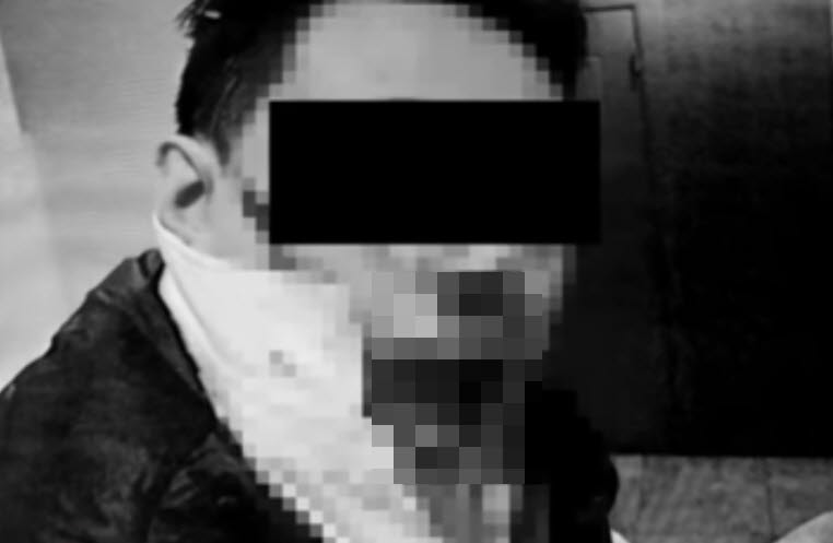 일면식 없는데 프라이팬으로 얼굴뼈 골절되게 폭행...'불구속'