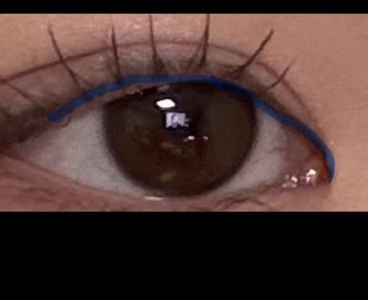 comment image 1