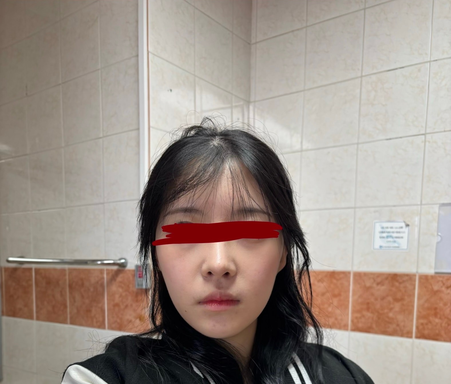 뭐가 문제지 대체 성형하면 이뻐질 줄 알았어