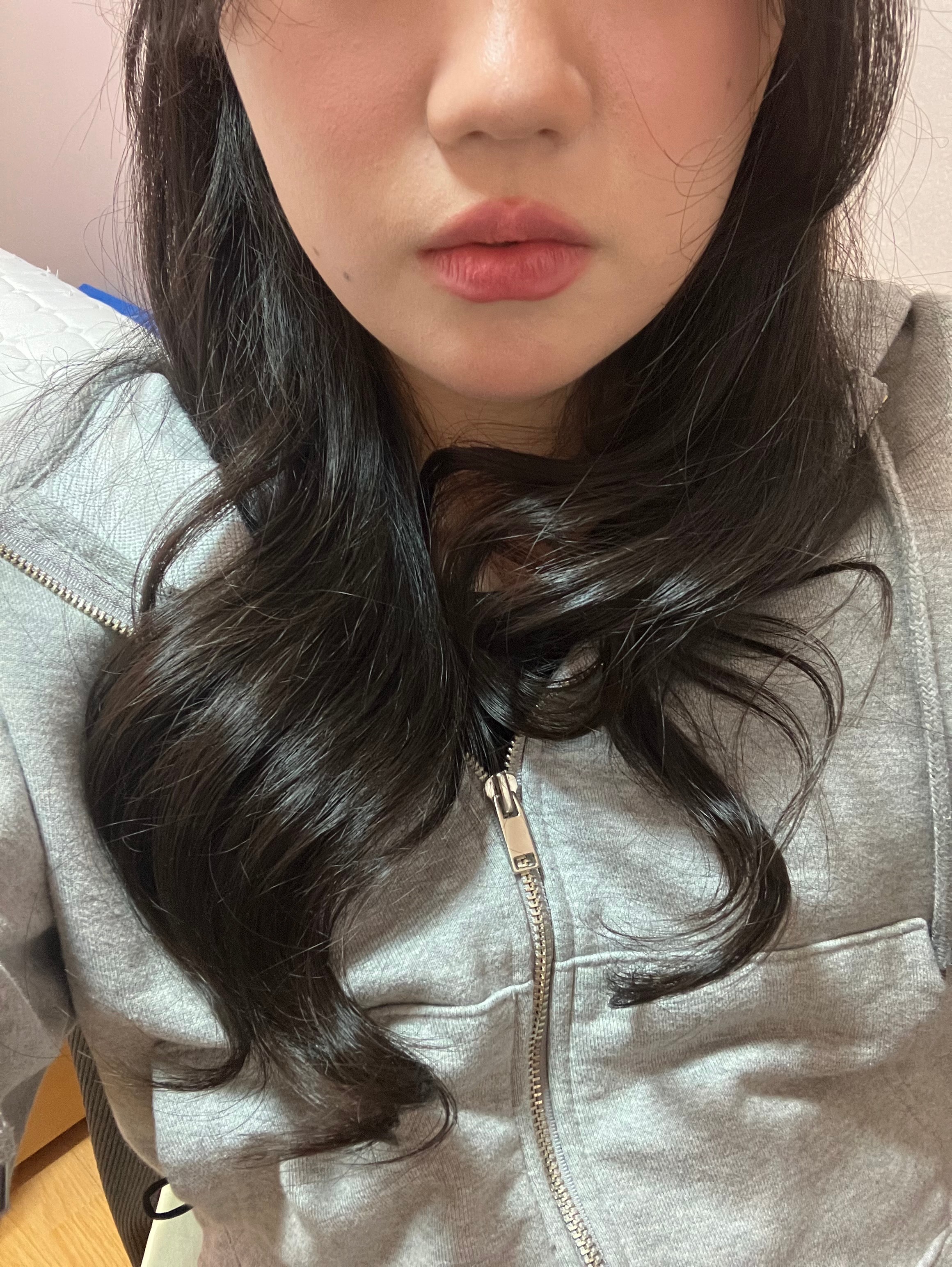 시술 뭐뭐 하는게 좋을까