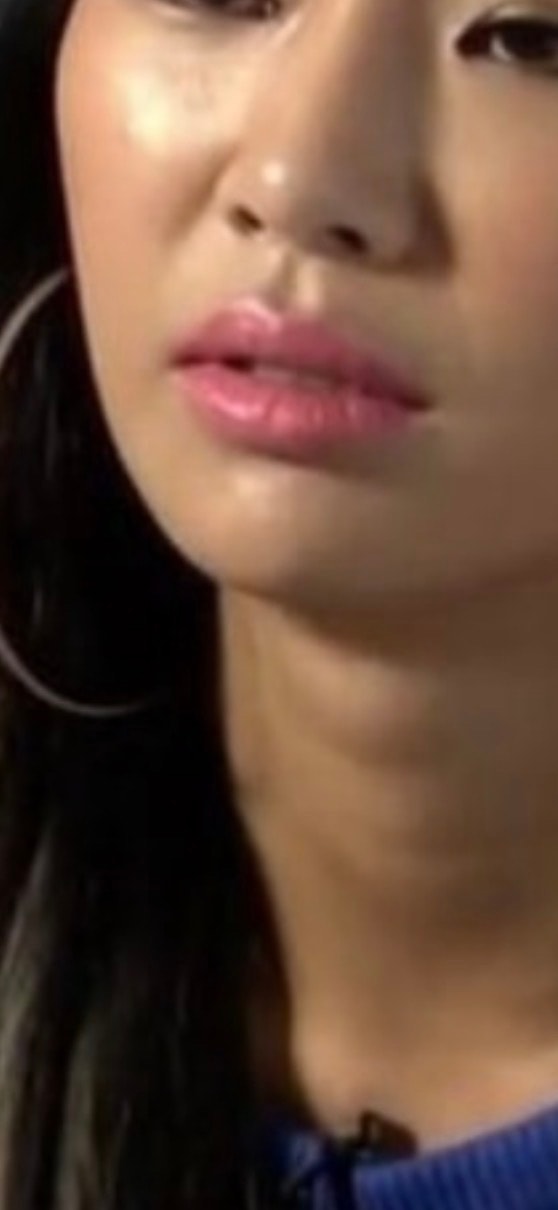 이런 건 무슨 시술 받아야대?