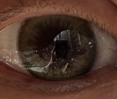 렌즈사고 남친한테 인증샷찍다가 소름돋음