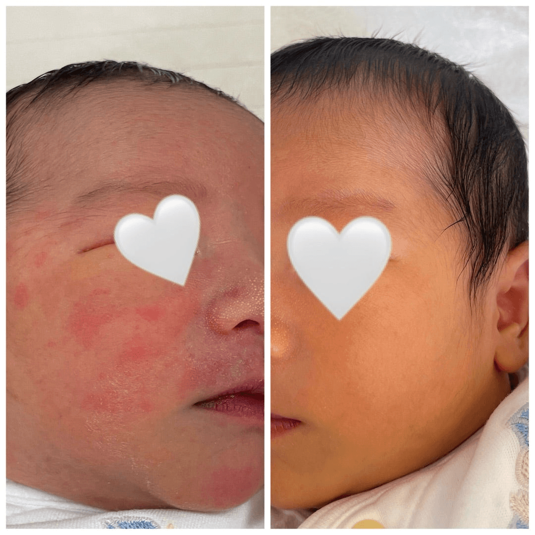 비포 애프터 대박이야