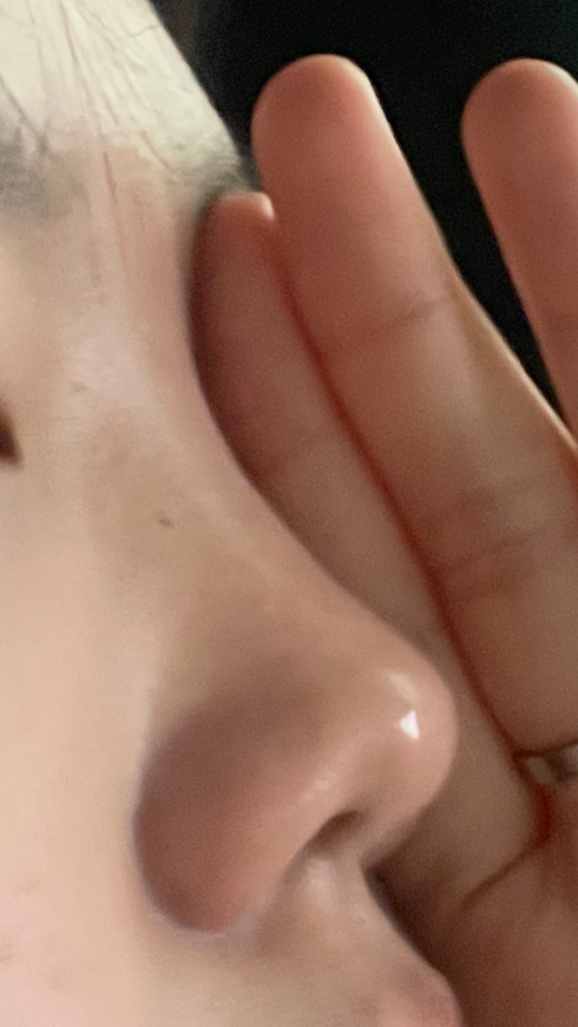 중3 너무 성형하고 싶어