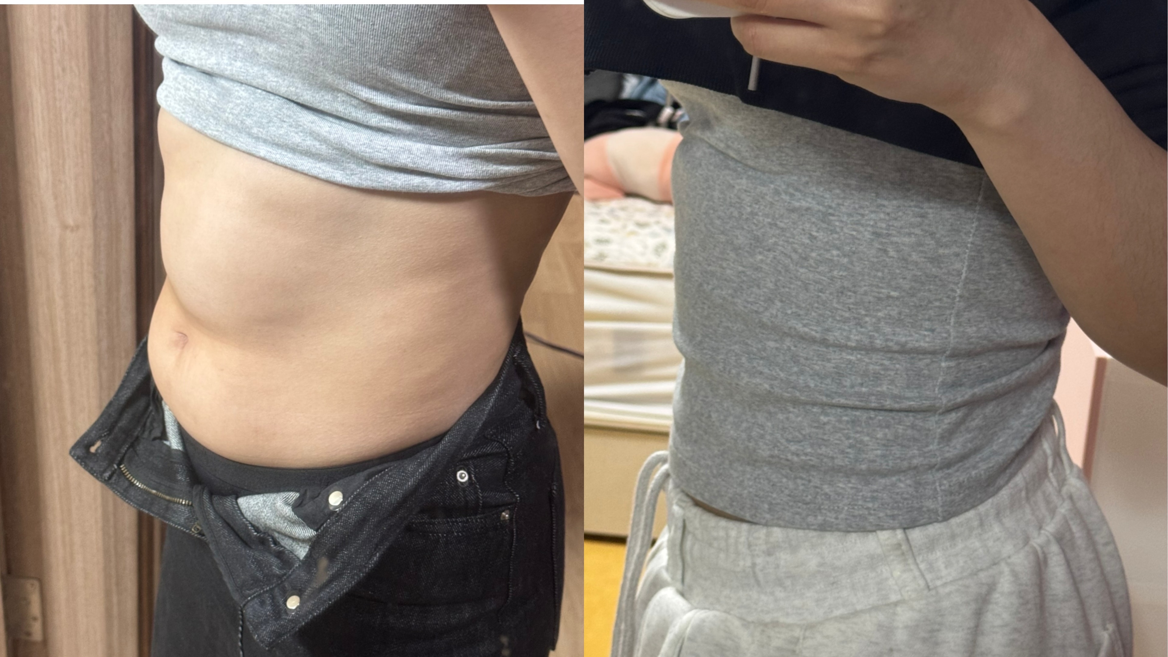 뱃살 접히는거 이걸로 해결했는데 어때요?