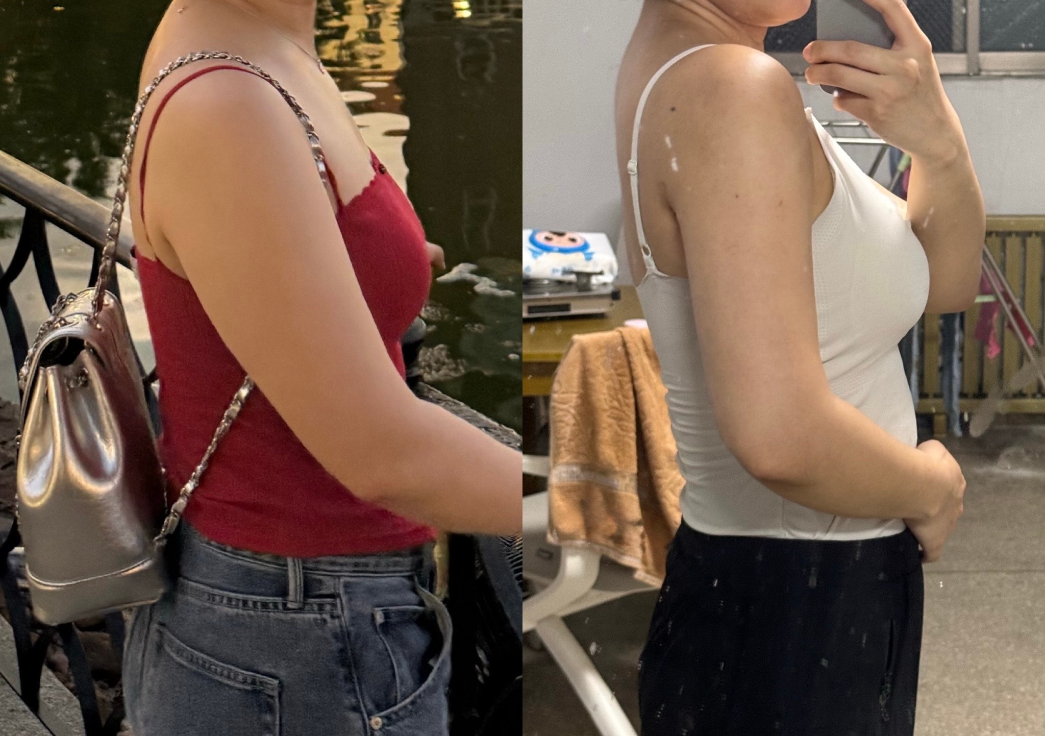 3n년 팔뚝 고민이라 지흡 받고왔어