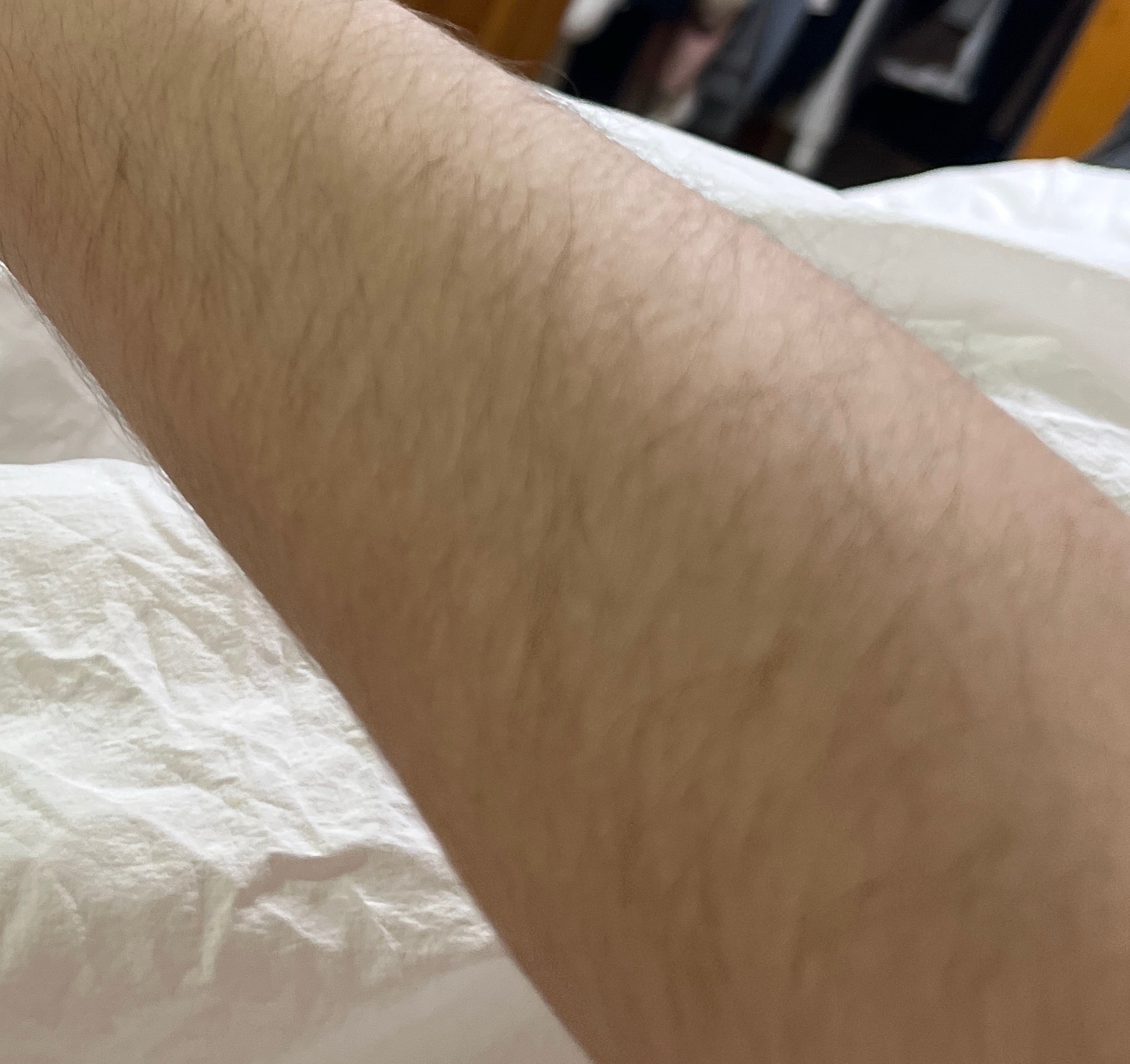 털많다 한사람인데 제모했어 봐주라 ㅠㅠ