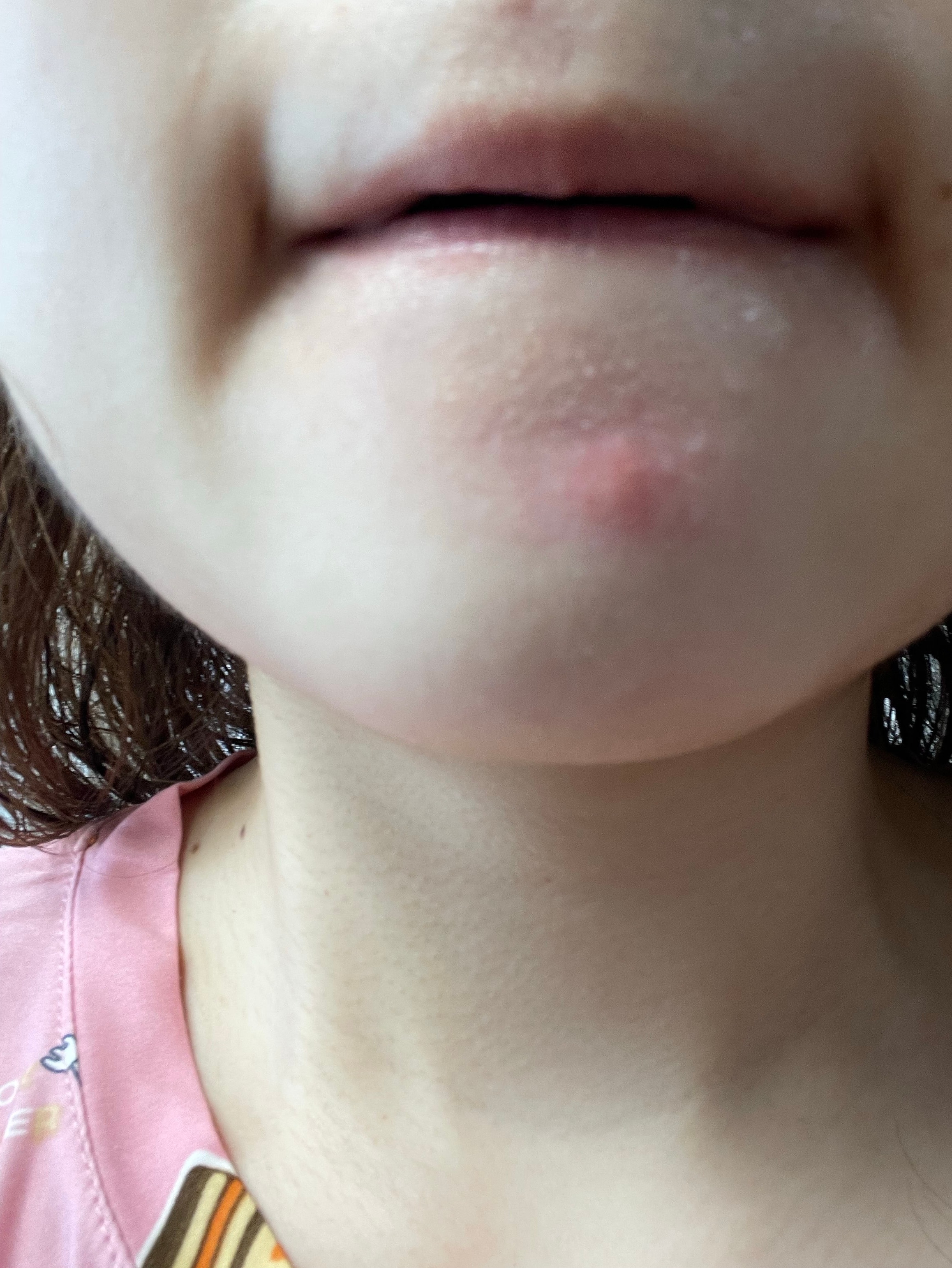 comment image 1