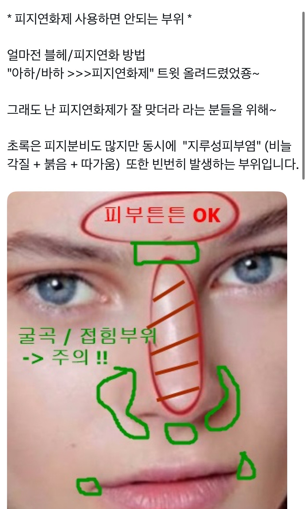 comment image 1