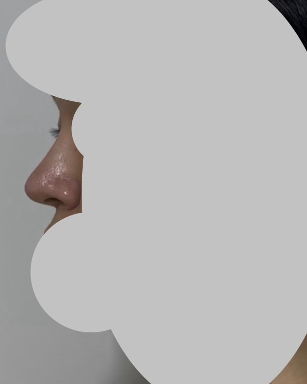 애들이 뒤에서 내 코 이야기했대