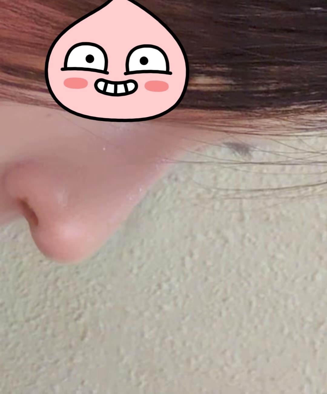 원장님이 나보고 6개월~1년 뒤에 코 재수술 하자는데