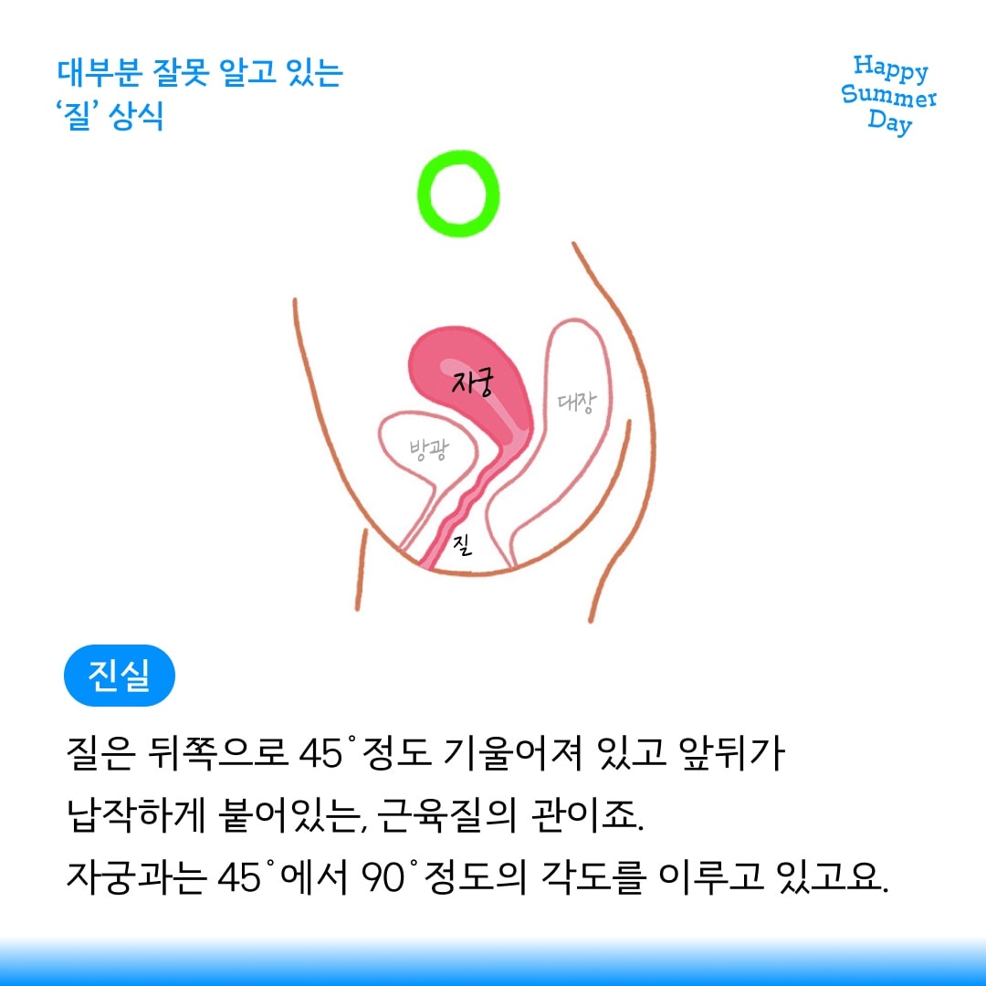 comment image 1