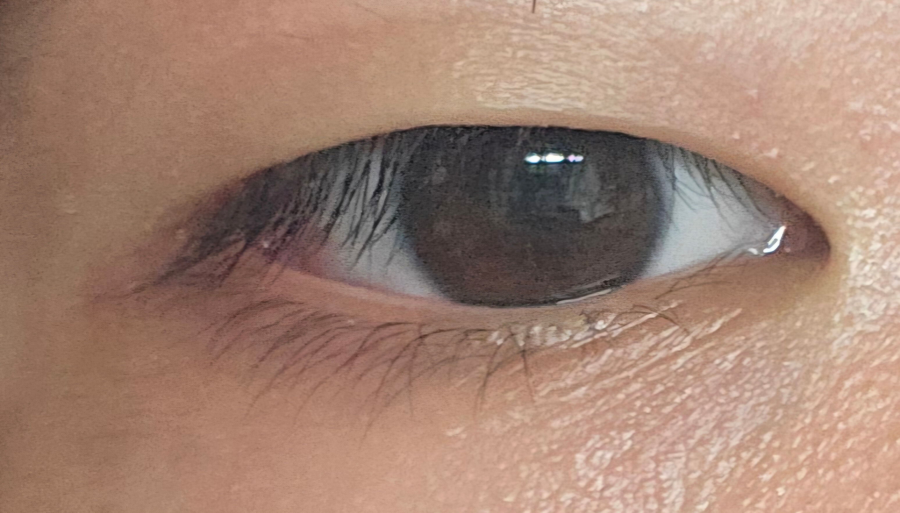 자꾸 주변에서 쌍수하라는데