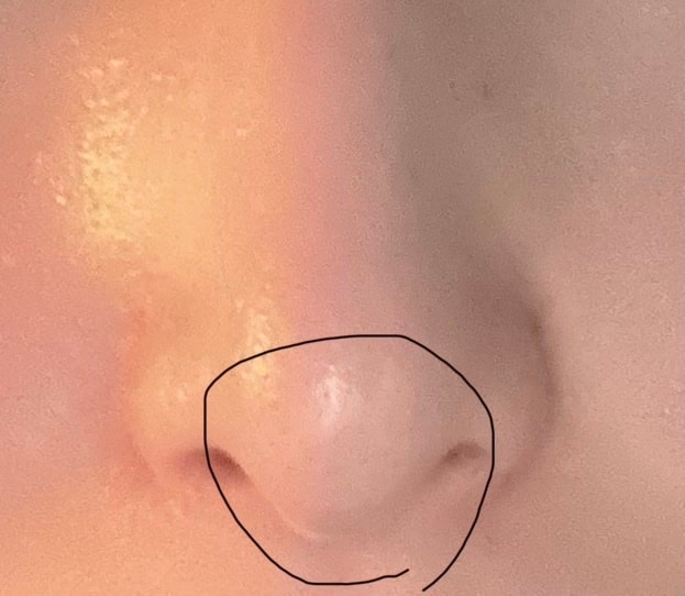 comment image 1
