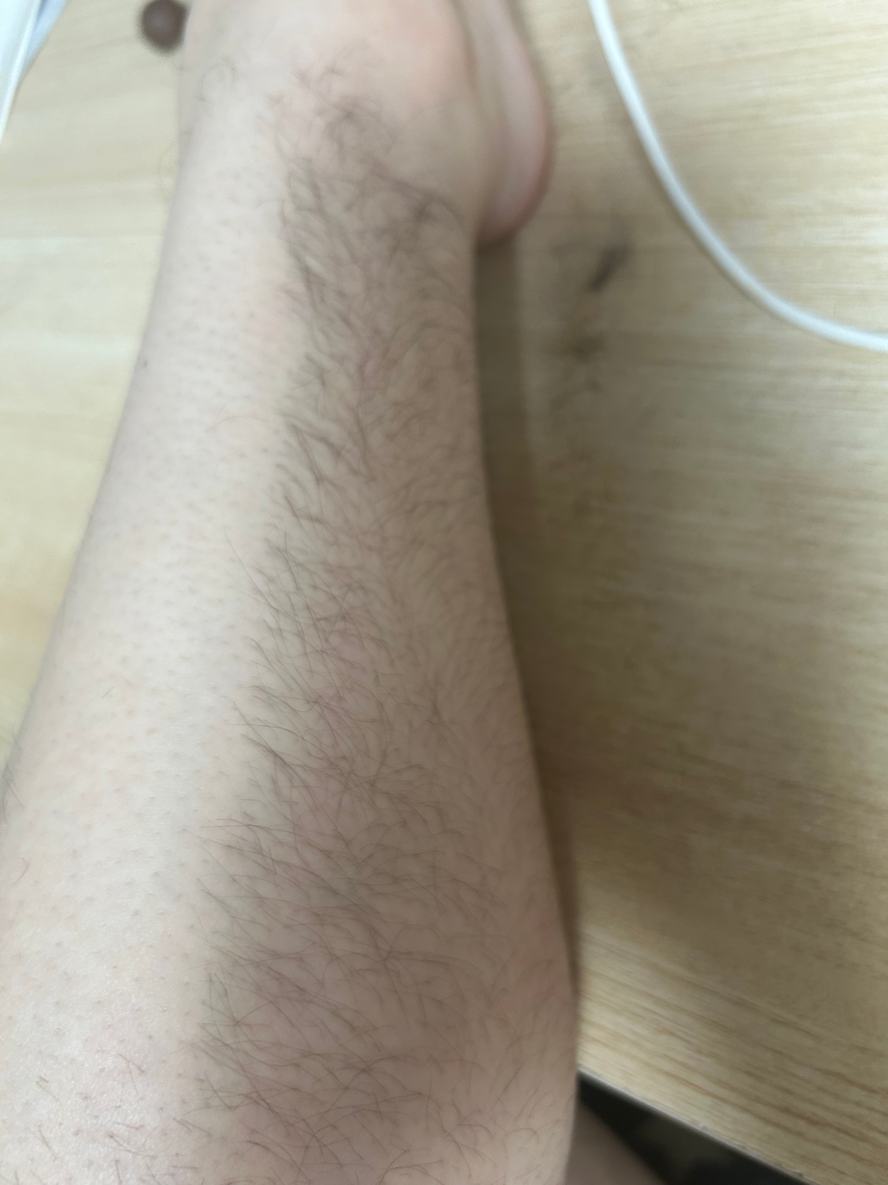 다리털 많은 사람인데 (사진잇음)