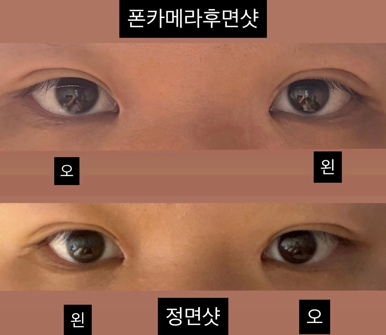 쌍수망한거같은데…as 받아야할거같아