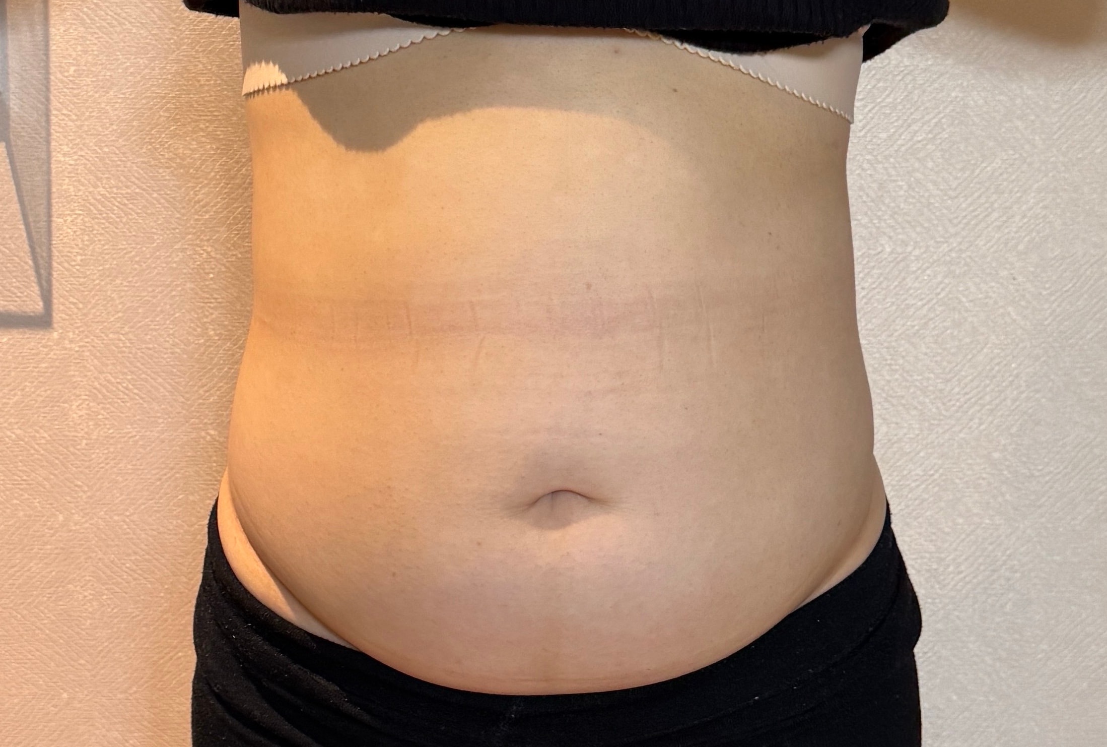 복부 지흡한지 한달차야 ㅎㅎ