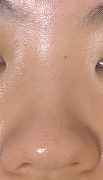 코성형... 봐주라 ㅠㅠ